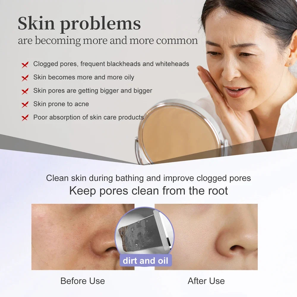 GlowPro Ultrasonic Skin Wand